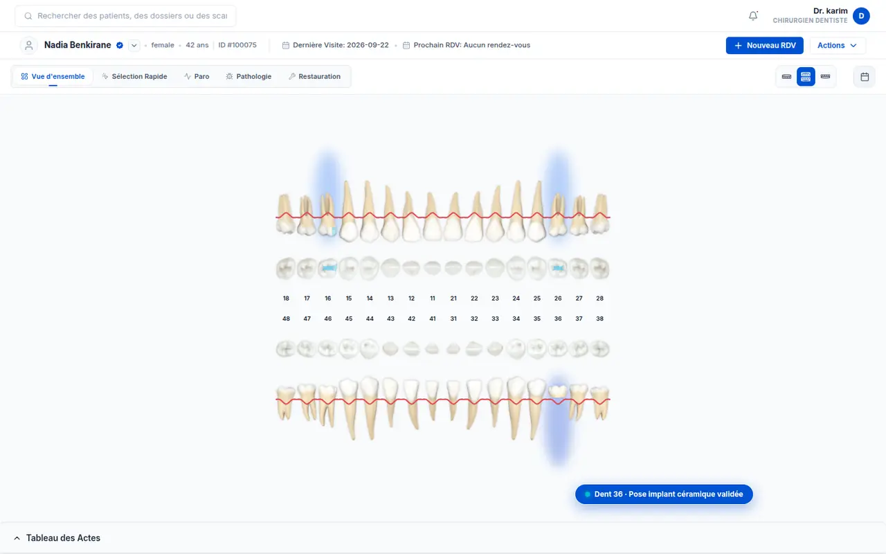 Schéma dentaire BeYouClinic : arcades et acte validé sur la dent 36
